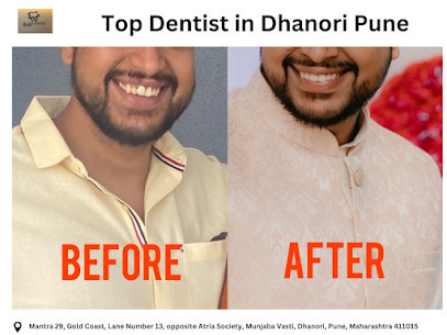 Dental Clinic in Dhanori