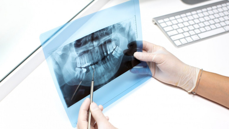 Preparing for Your Dental Radiology Appointment: Tips and Expectations