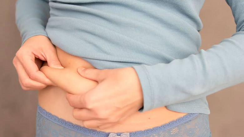 Recovery After Liposuction Key Insights from Best Liposuction Surgeon in Dubai