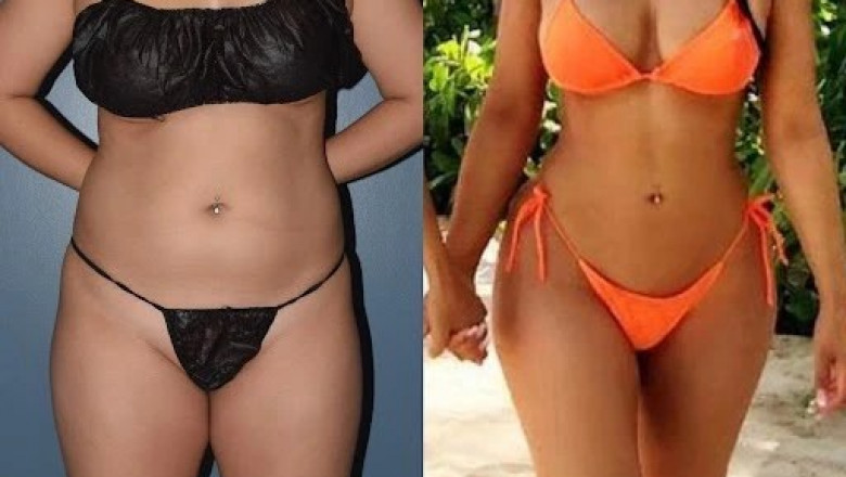 Progress After the Procedure Mastering Liposuction Recovery in Dubai