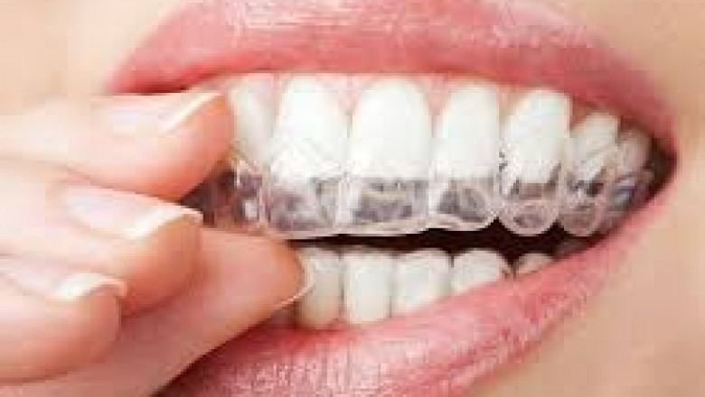 Orthopedic Braces & Supports Market Driven by Aging Population and Injuries
