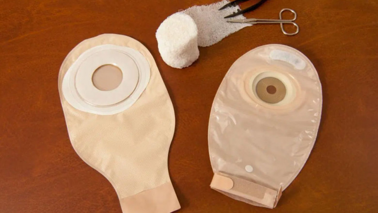 Ostomy Devices Market Poised for Growth Due to Increasing Colorectal and Bladder Cancer Cases