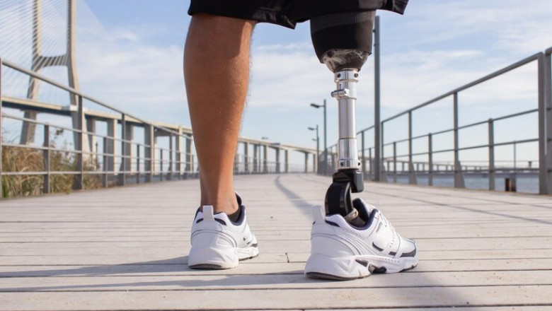 Artificial Limbs Market Research Unlocks New Avenues in Prosthetic Innovation