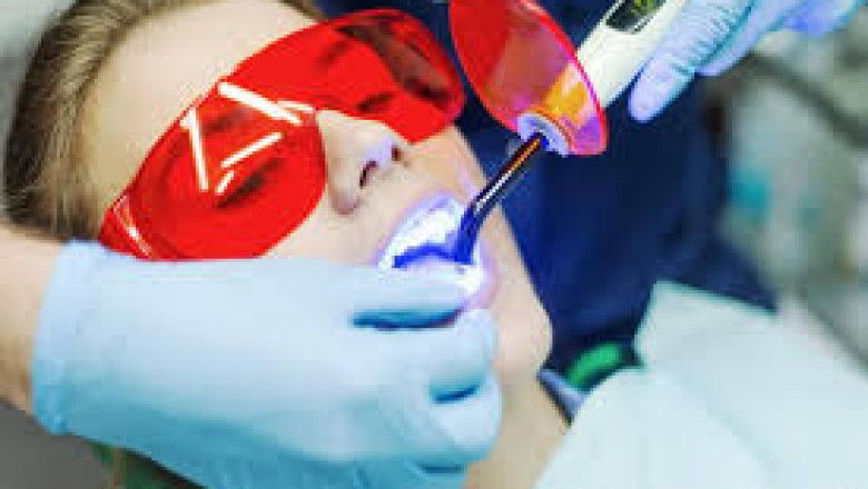 Dental Lasers Market Summary Highlights Growth, Trends, and Opportunities