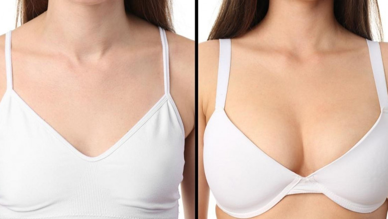 How the Best Breast Augmentation Surgeons in Dubai Personalize Each Procedure