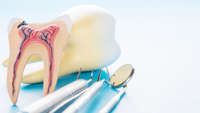 Comprehensive General Dentistry Services in Westchase, TX: Crowns, Root Canals, Implants & More