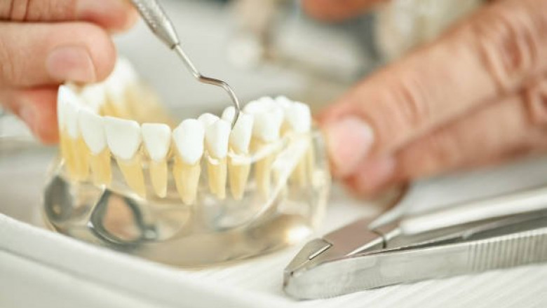 Dental Crowns in Avon, Ohio – Restore Strength, Function, and Beauty to Your Smile