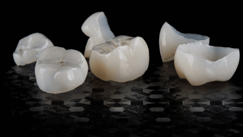 Same Day Crowns - Dental Restorations That Are Durable, Long-Lasting, and Aesthetically Pleasurable