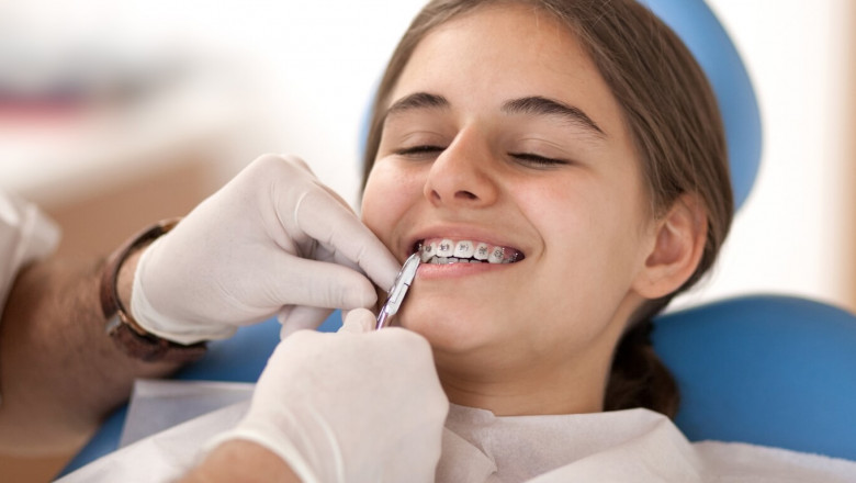 What Does an Orthodontist Do? A Beginner’s Guide to Straightening Your Smile