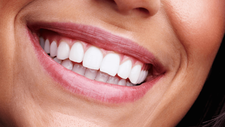 What Is Full Mouth Reconstruction?