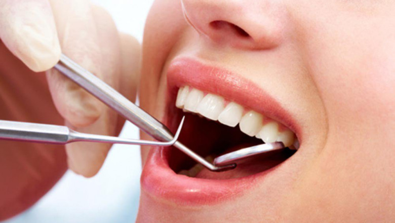 Dental Silver Diamine Fluoride Market Research Reveals Key Trends, Regional Insights, and Consumer Preferences