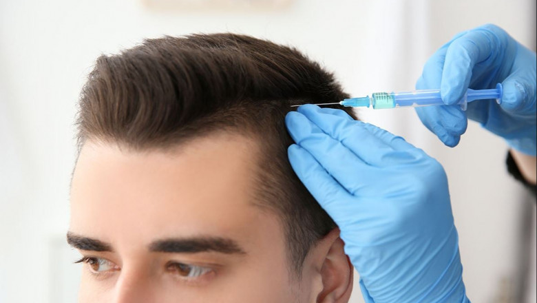 Hair Restoration Market: Pricing Strategies, Patient Financing, and Market Penetration