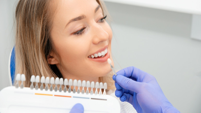 Teeth Whitening vs. Veneers: Which Option Is Right for You? Advice from a Dentist in South Edmonton