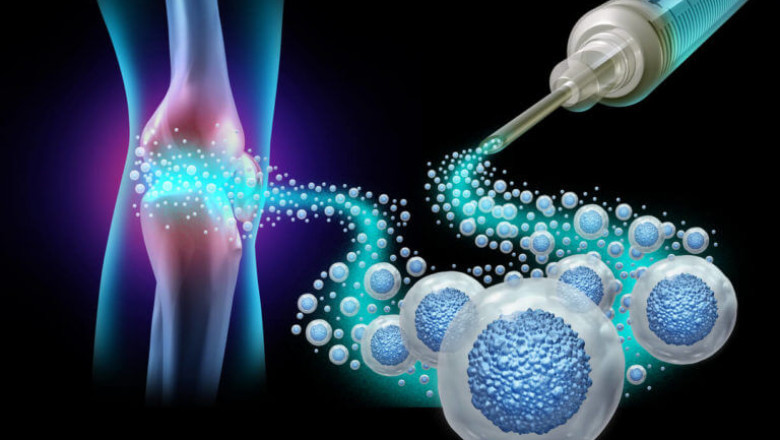 Stem Cell Therapy Market Research: Trends, Growth &amp; Future Outlook