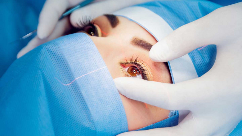 LASIK Eye Surgery Market Driving Growth Through Advanced Technology and Expanding Global Demand