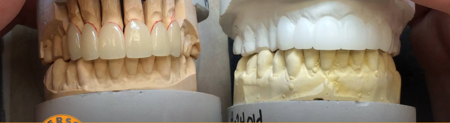 IversonDentalLab