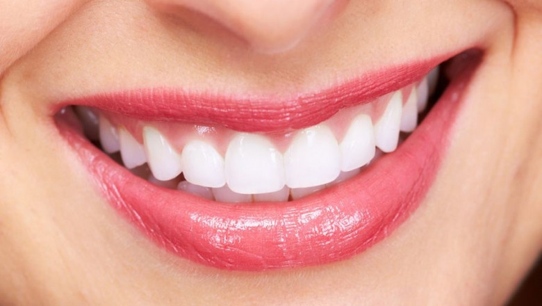 How Veneers in Dubai Can Transform Your Smile and Boost Your Confidence