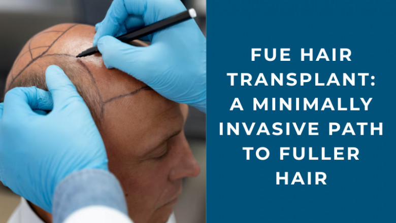FUE Hair Transplant: A Minimally Invasive Path to Fuller Hair