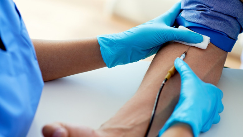 Convenient Blood Test at Home Bangalore – Get Accurate Results from EcoTown Diagnostics