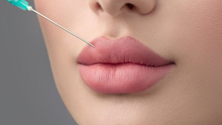 The Best Aesthetic Clinics in Dubai Explain the Russian Lip Fillers