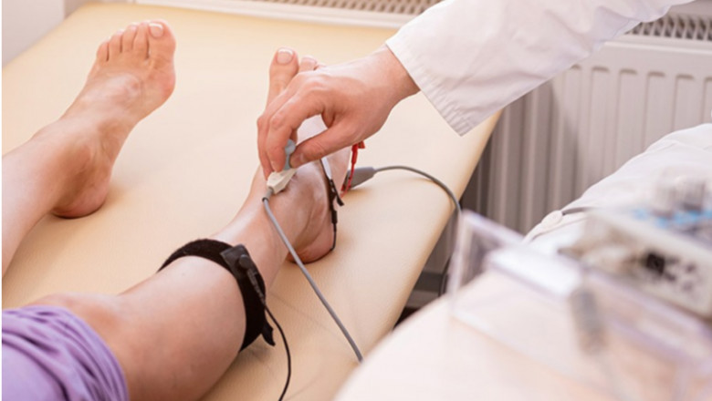 Know the EMG Test Cost & Book at Low Price Today