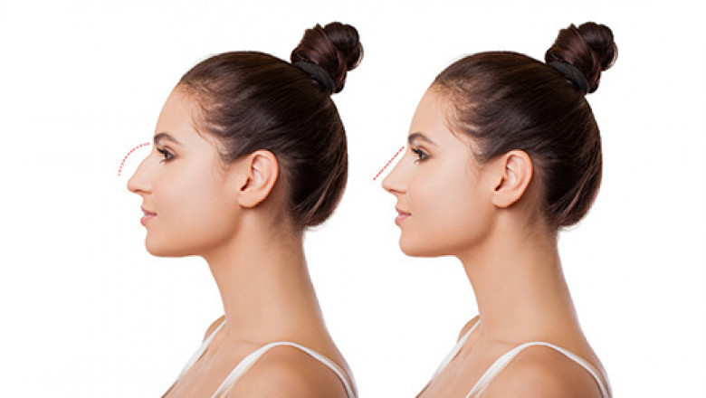 Is Abdominoplasty in Dubai Right for You? Understanding the Procedure and Results