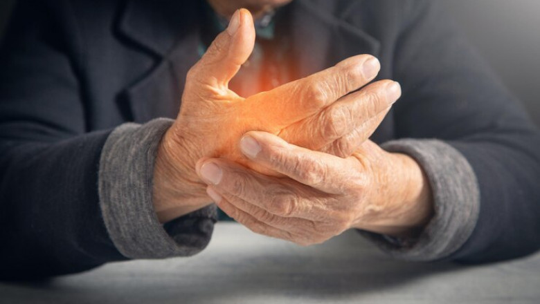 Arthritis Therapeutics Market Faces Challenges Amid Advancing Treatments and Aging Population