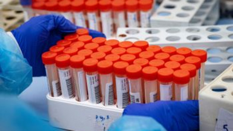 Global COVID-19 Sample Collection Kits Market Dynamics and Future Outlook to 2030