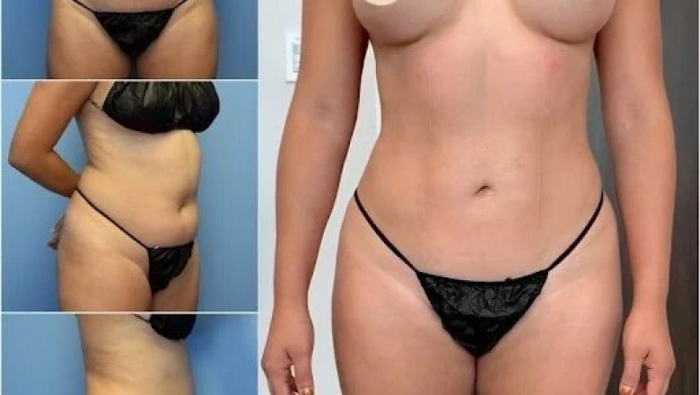 The Best Doctors in Dubai for Body Contouring: Your Path to a More Defined Body