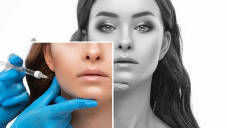 Profhilo for Every Skin Type: How the Best Plastic Surgeon in Dubai Customizes It