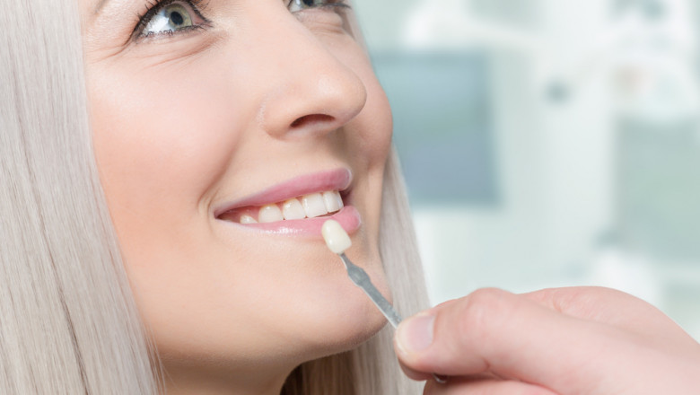 Dental Crowns, Veneers, and Teeth Whitening