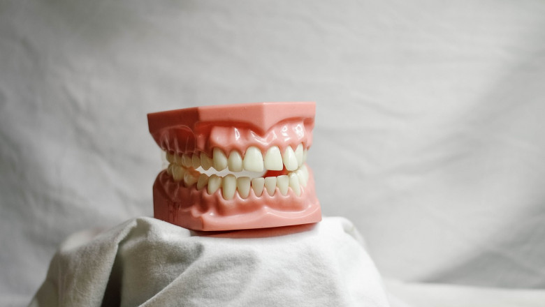 Can You Replace Old Fillings with White Ones?