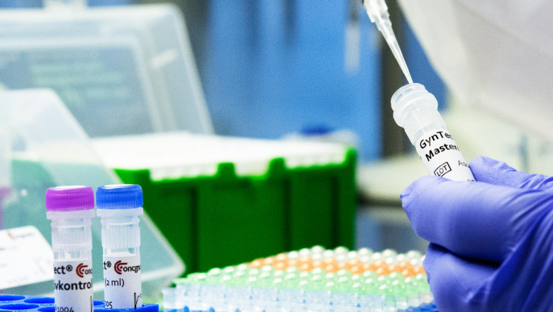 In Vitro Diagnostics Test Kit Market Innovations Showcase Lab-on-a-Chip Technology Applications