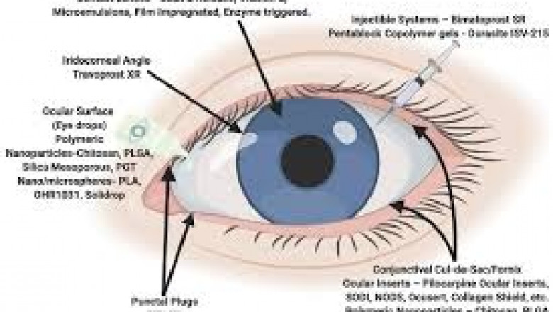 Ocular Drug Delivery System Market Global Forecast Report with Key Insights Till 2030