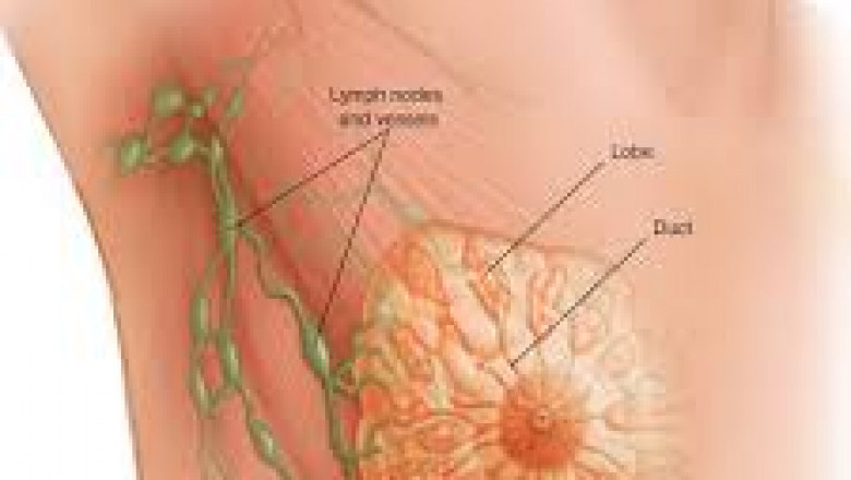 Key Drivers and Challenges in the Global Breast Cancer Market Outlook 2022–2032