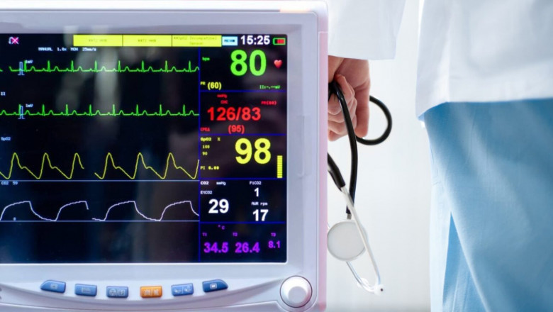 Global Capnography Market Report 2021–2030: Growth Trends, Key Players, and Forecast Analysis