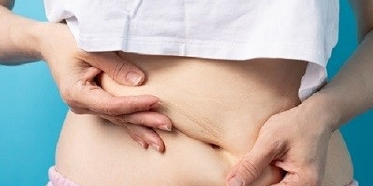 Are There Any Risks Associated with Liposuction in Islamabad?