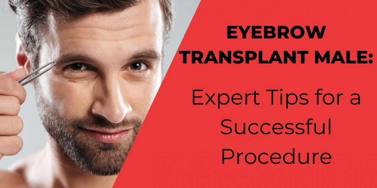 Eyebrow Transplant Male: Expert Tips for a Successful Procedure