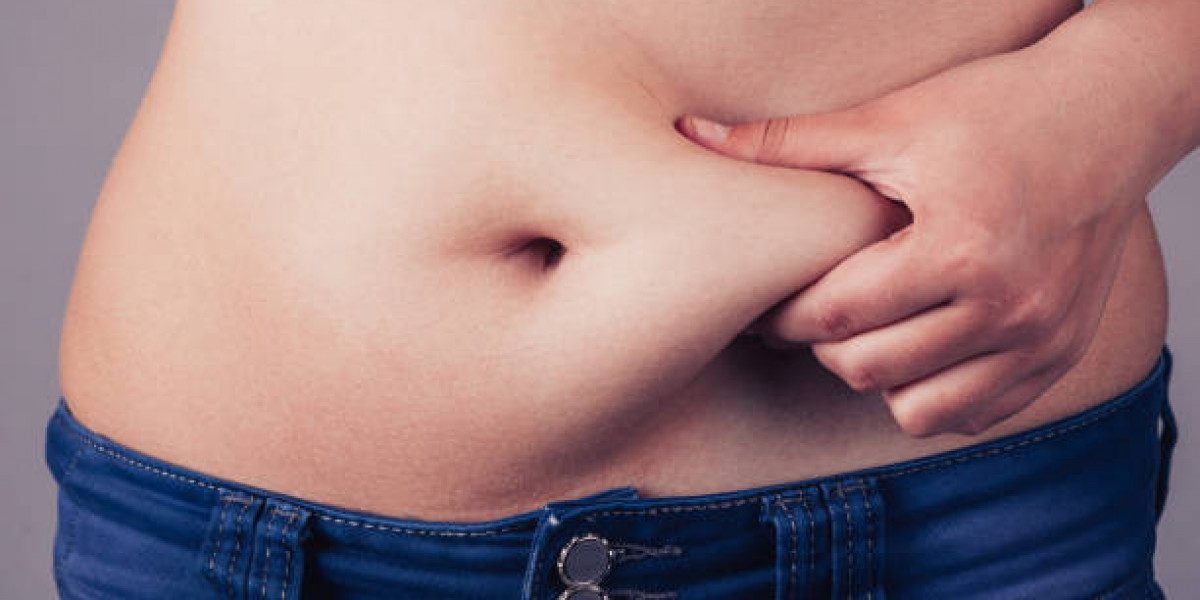 Is Liposuction Safe? Debunking Common Myths About Liposuction in Islamabad