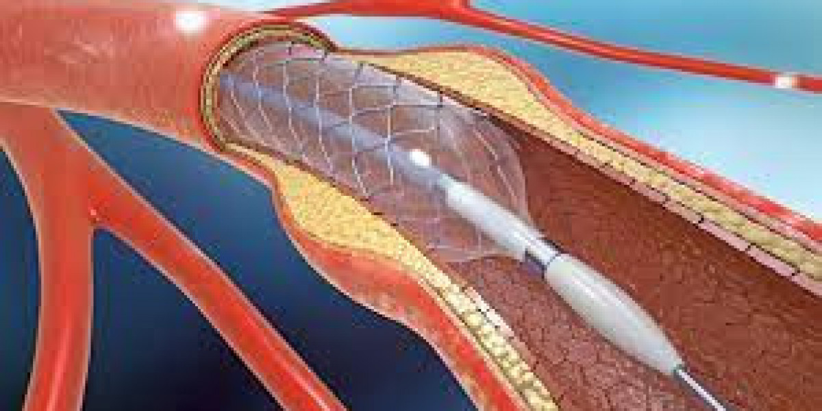 Angioplasty Balloons Market Disruptions in the Healthcare Sector and Impact on Patient Outcomes