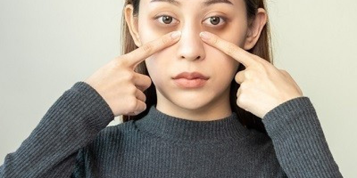 Combat Dark Circles with These Top Treatments in Islamabad