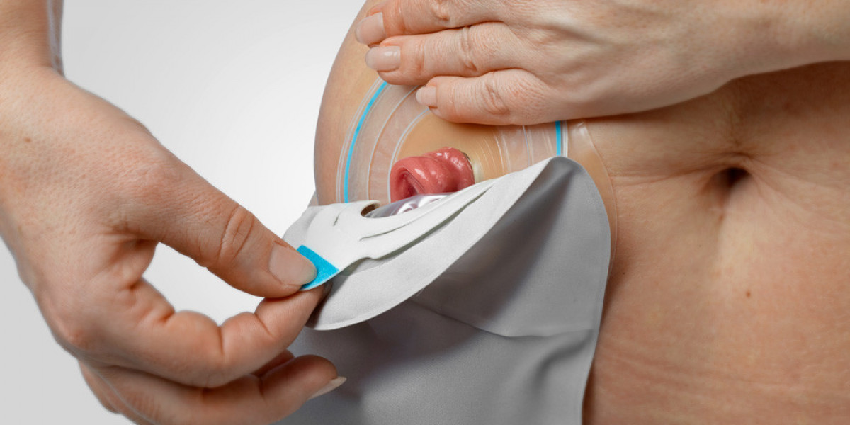 Ostomy Devices Market: Navigating Strategic Moves for Competitive Advantage