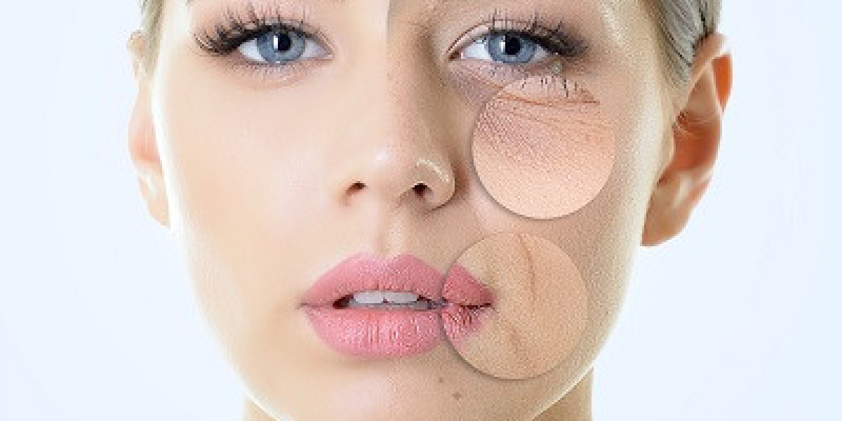 How to Take Care of Your Skin Post Wrinkle Removal Treatments