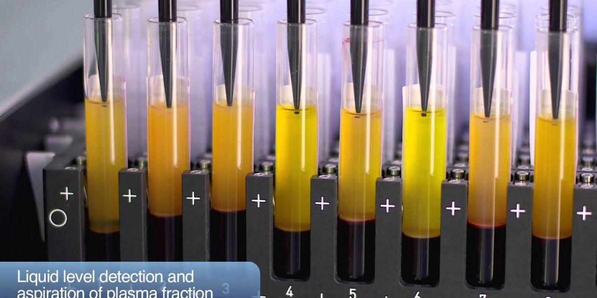 The Growing Demand for Plasma Fractionation: Key Trends and Market Insights
