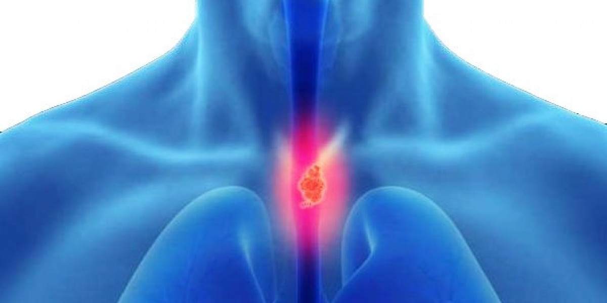 Laparoscopic Esophageal Surgery in Delhi: Precision Care for Complex Esophageal Disorders