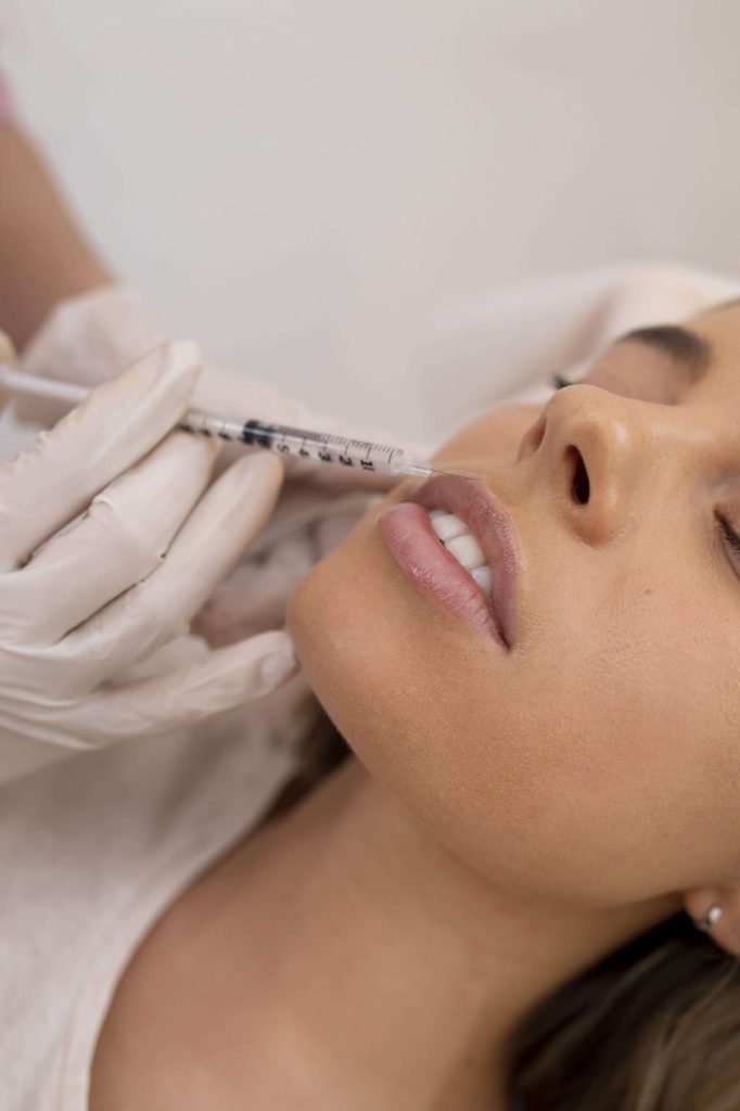Effective Lip Augmentation Filler London - Belle Clinic London