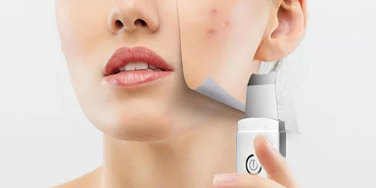 Anti-Acne Dermal Patch Market Landscape: Trends, Growth, and Future Opportunities Explored
